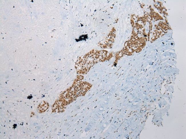 WDR45 Antibody in Immunohistochemistry (Paraffin) (IHC (P))