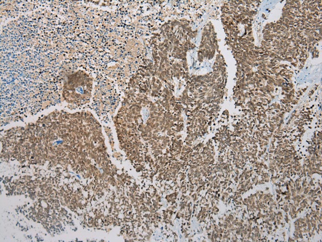 DCAF7 Antibody in Immunohistochemistry (Paraffin) (IHC (P))