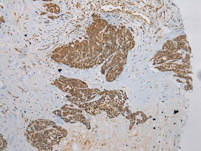 DCAF7 Antibody in Immunohistochemistry (Paraffin) (IHC (P))