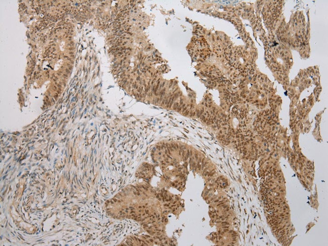 WSB1 Antibody in Immunohistochemistry (Paraffin) (IHC (P))