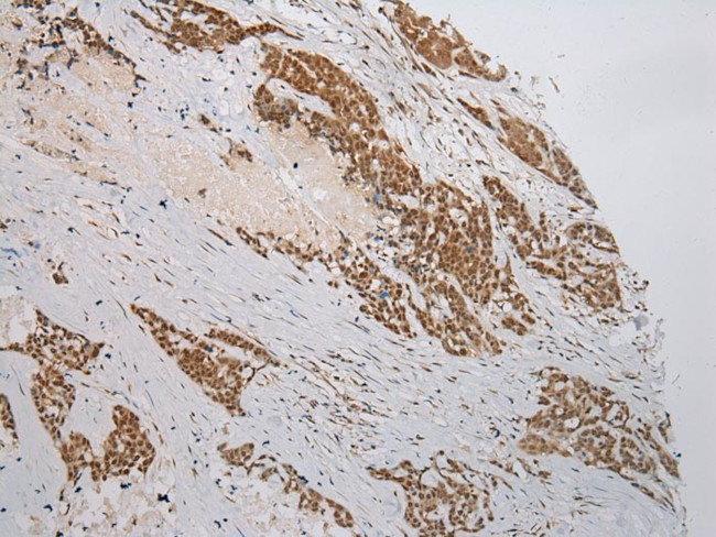 WSB1 Antibody in Immunohistochemistry (Paraffin) (IHC (P))