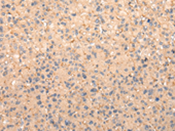 ZFAND1 Antibody in Immunohistochemistry (Paraffin) (IHC (P))