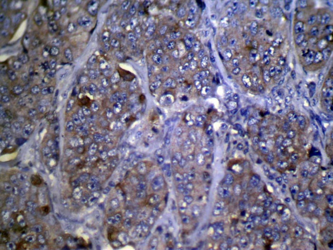 ZFP2 Antibody in Immunohistochemistry (Paraffin) (IHC (P))