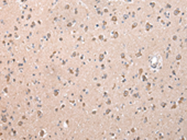 ZCCHC9 Antibody in Immunohistochemistry (Paraffin) (IHC (P))