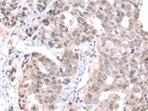 PCID2 Antibody in Immunohistochemistry (Paraffin) (IHC (P))