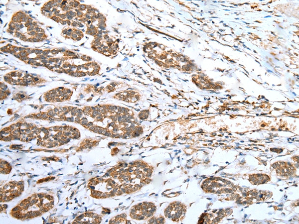 ACBD4 Antibody in Immunohistochemistry (Paraffin) (IHC (P))