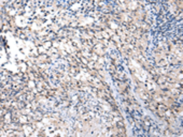 MMGT1 Antibody in Immunohistochemistry (Paraffin) (IHC (P))