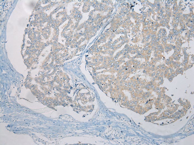 LSM11 Antibody in Immunohistochemistry (Paraffin) (IHC (P))