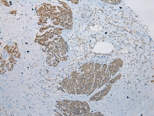 LSM11 Antibody in Immunohistochemistry (Paraffin) (IHC (P))