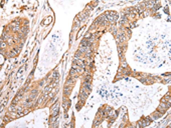 KCTD16 Antibody in Immunohistochemistry (Paraffin) (IHC (P))