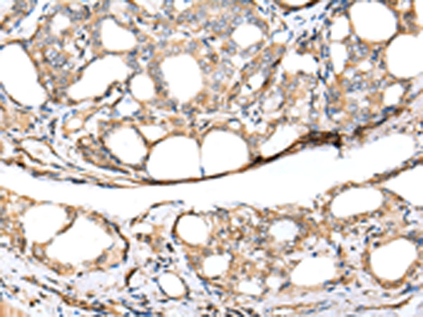 KCTD16 Antibody in Immunohistochemistry (Paraffin) (IHC (P))