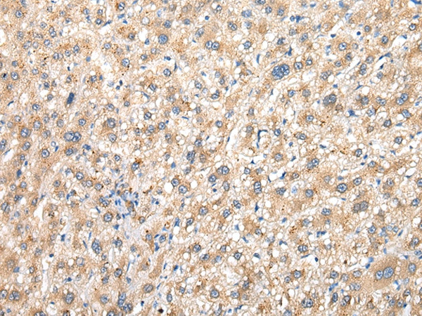 PRG3 Antibody in Immunohistochemistry (Paraffin) (IHC (P))