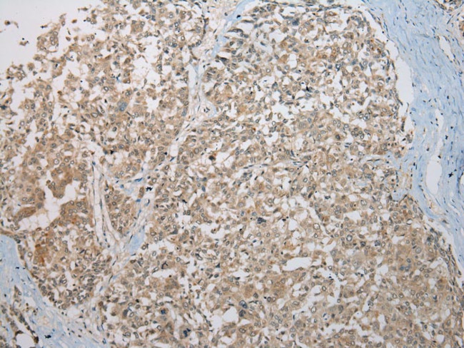 Kazrin Antibody in Immunohistochemistry (Paraffin) (IHC (P))