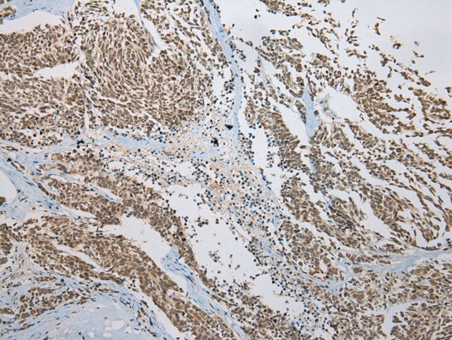 Kazrin Antibody in Immunohistochemistry (Paraffin) (IHC (P))