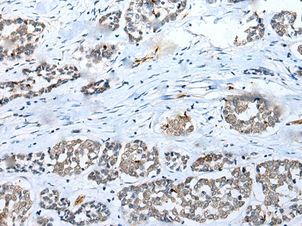 C22orf41 Antibody in Immunohistochemistry (Paraffin) (IHC (P))