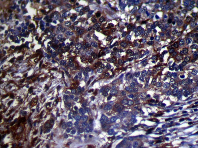 GMFB Antibody in Immunohistochemistry (Paraffin) (IHC (P))