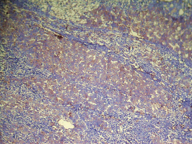 DHRSX Antibody in Immunohistochemistry (Paraffin) (IHC (P))