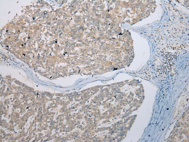 UBE2Z Antibody in Immunohistochemistry (Paraffin) (IHC (P))