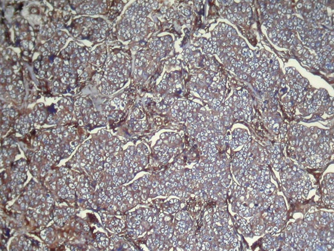 UGT3A1 Antibody in Immunohistochemistry (Paraffin) (IHC (P))