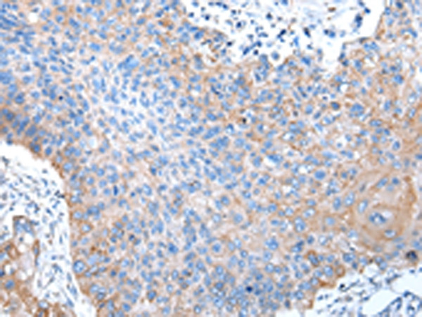 PTGIR Antibody in Immunohistochemistry (Paraffin) (IHC (P))