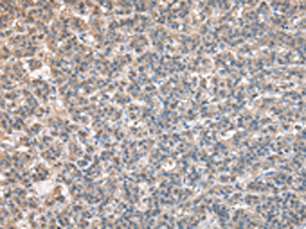 TAF172 Antibody in Immunohistochemistry (Paraffin) (IHC (P))