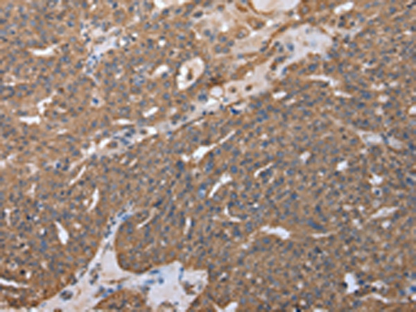 RARS Antibody in Immunohistochemistry (Paraffin) (IHC (P))