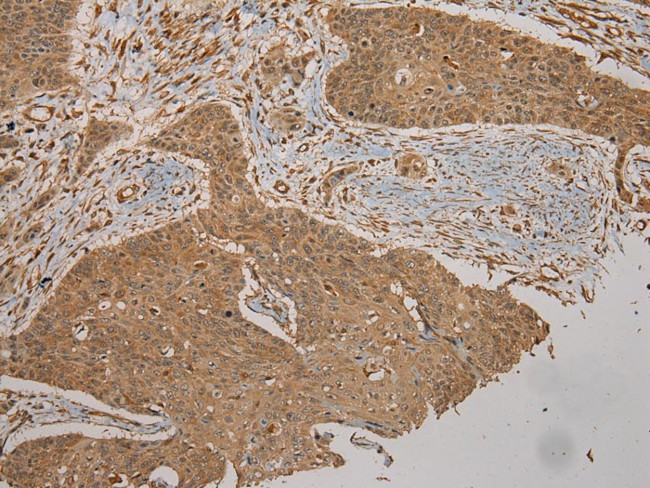 CYP20A1 Antibody in Immunohistochemistry (Paraffin) (IHC (P))