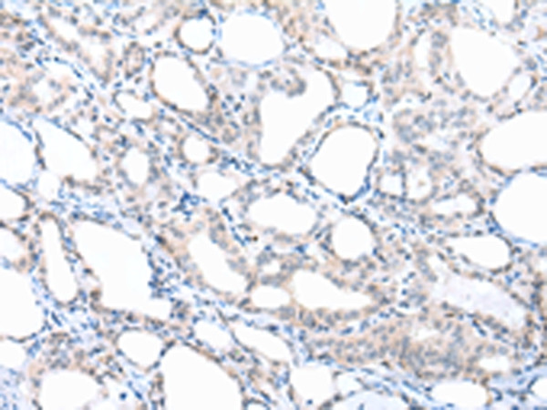 PPBP Antibody in Immunohistochemistry (Paraffin) (IHC (P))