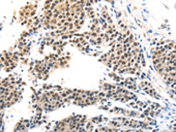 MAGEA6 Antibody in Immunohistochemistry (Paraffin) (IHC (P))