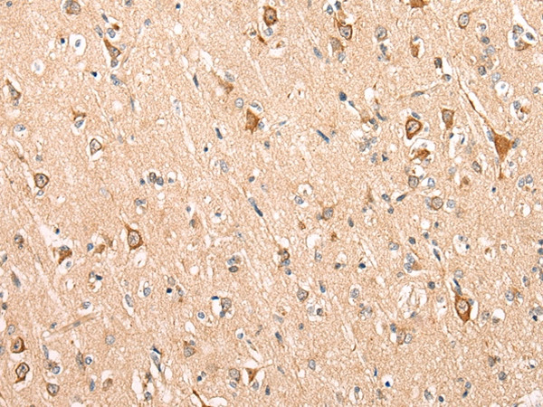 ADAM19 Antibody in Immunohistochemistry (Paraffin) (IHC (P))