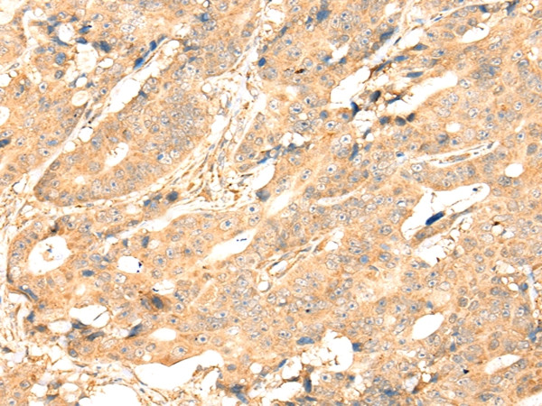 ADAM19 Antibody in Immunohistochemistry (Paraffin) (IHC (P))