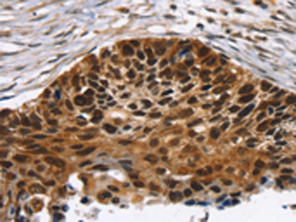 TACC2 Antibody in Immunohistochemistry (Paraffin) (IHC (P))