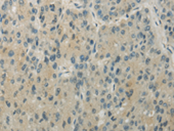 WRCH1 Antibody in Immunohistochemistry (Paraffin) (IHC (P))