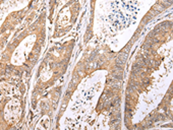 XKR7 Antibody in Immunohistochemistry (Paraffin) (IHC (P))