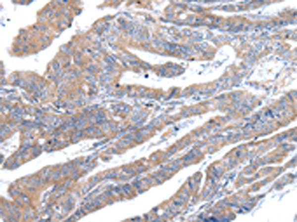 ZFAND2A Antibody in Immunohistochemistry (Paraffin) (IHC (P))