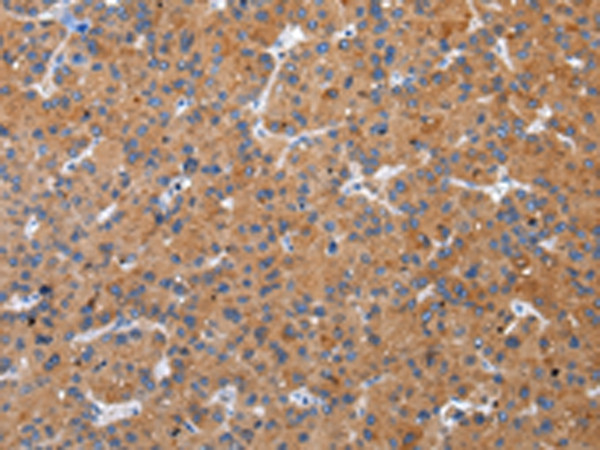 ZFAND2A Antibody in Immunohistochemistry (Paraffin) (IHC (P))