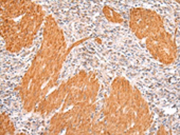 IKZF4 Antibody in Immunohistochemistry (Paraffin) (IHC (P))