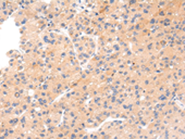 IKZF4 Antibody in Immunohistochemistry (Paraffin) (IHC (P))