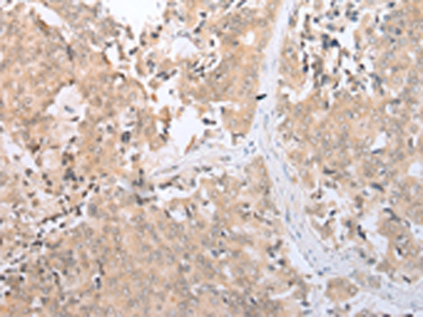 SLC2A6 Antibody in Immunohistochemistry (Paraffin) (IHC (P))