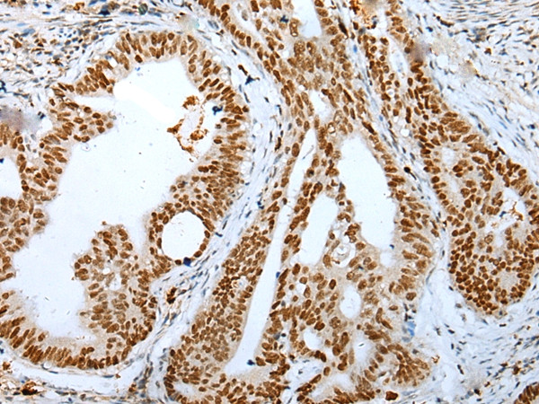 DEK Antibody in Immunohistochemistry (Paraffin) (IHC (P))