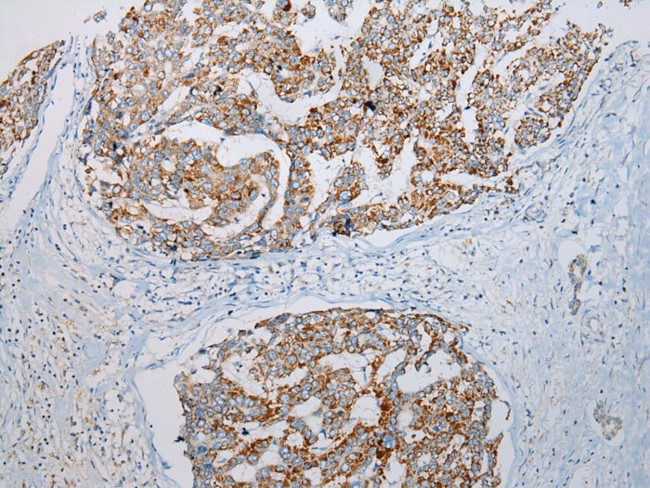 ADAMTS3 Antibody in Immunohistochemistry (Paraffin) (IHC (P))