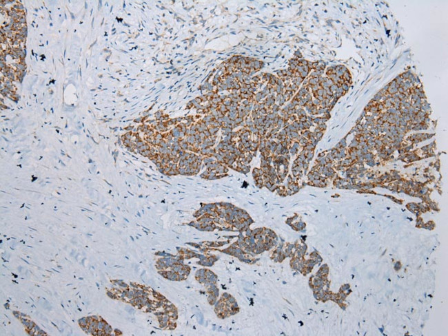 ADAMTS3 Antibody in Immunohistochemistry (Paraffin) (IHC (P))