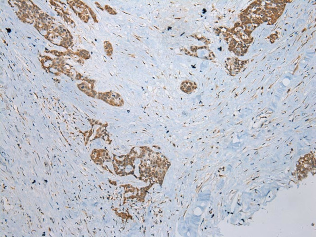 CCBL1 Antibody in Immunohistochemistry (Paraffin) (IHC (P))