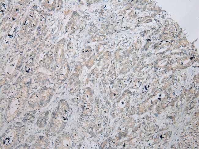 ZNF621 Antibody in Immunohistochemistry (Paraffin) (IHC (P))