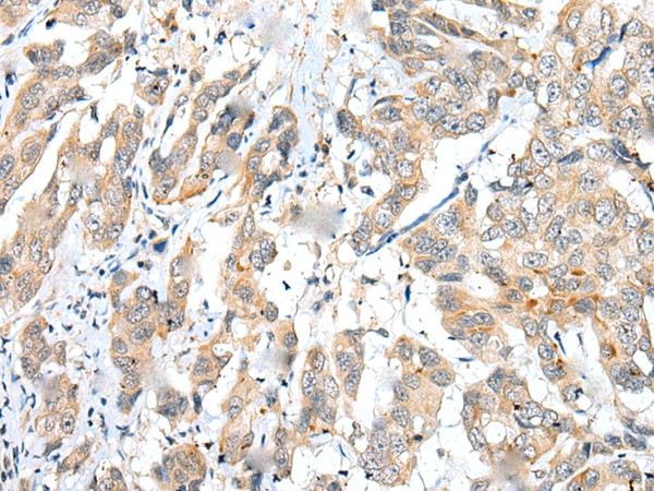 FUOM Antibody in Immunohistochemistry (Paraffin) (IHC (P))