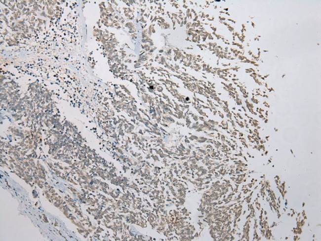 FAM101A Antibody in Immunohistochemistry (Paraffin) (IHC (P))