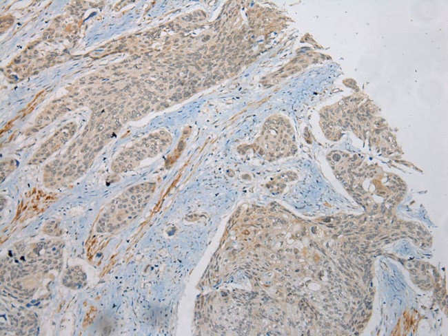 PLA2G12A Antibody in Immunohistochemistry (Paraffin) (IHC (P))