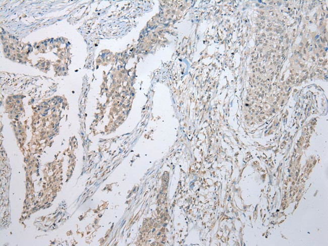 UBE2U Antibody in Immunohistochemistry (Paraffin) (IHC (P))