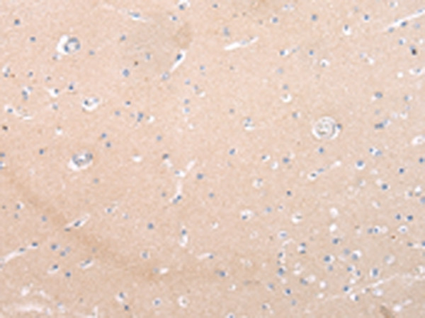 ZNF106 Antibody in Immunohistochemistry (Paraffin) (IHC (P))