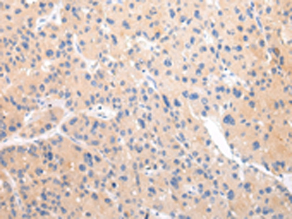 ZNF106 Antibody in Immunohistochemistry (Paraffin) (IHC (P))